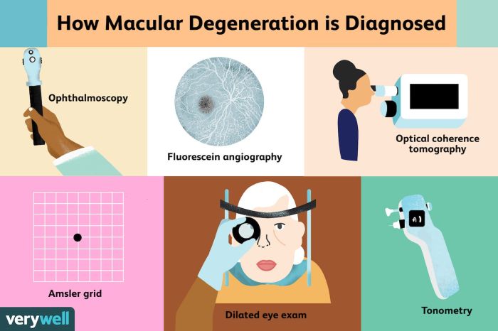 Nursing diagnosis for macular degeneration