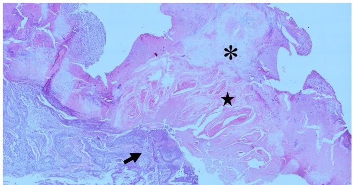 Label the photomicrograph of thin skin