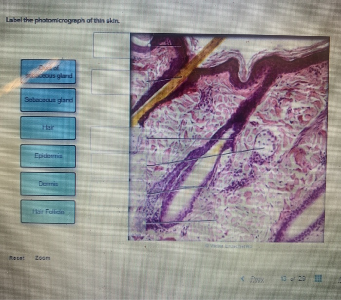 Histology follicle integumentary microscopic follicles scalp epidermis histological physiology pele escolha pasta