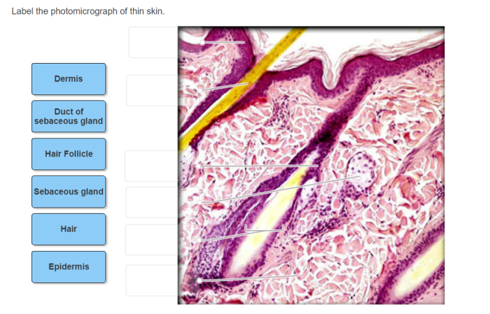 Label the photomicrograph of thin skin