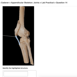 Pal cadaver appendicular skeleton joints lab practical question 2